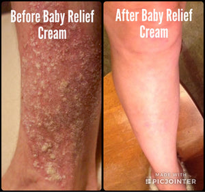 Baby Relief Cream