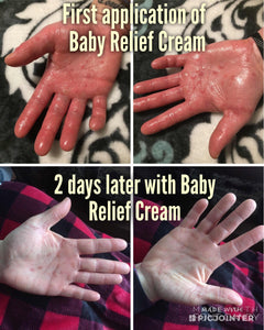 Baby Relief Cream